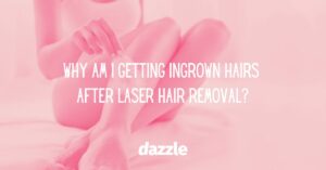 Woman in the background with text why am i getting ingrown hairs after laser hair removal