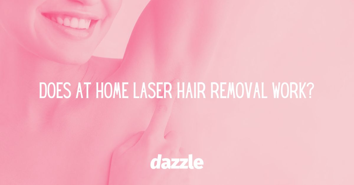 Does at home laser hair removal work banner image