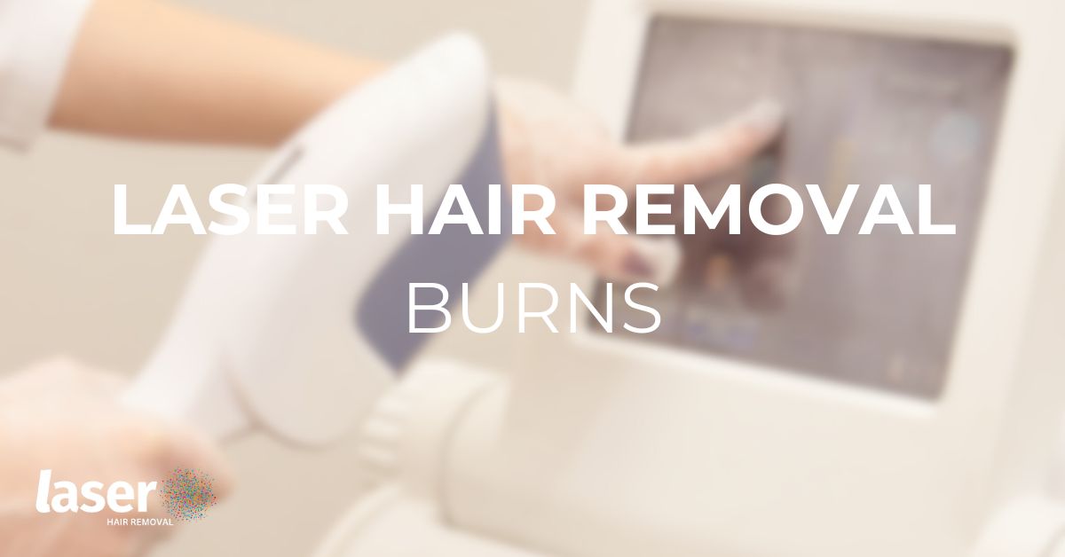 Laser hair removal burns featured image
