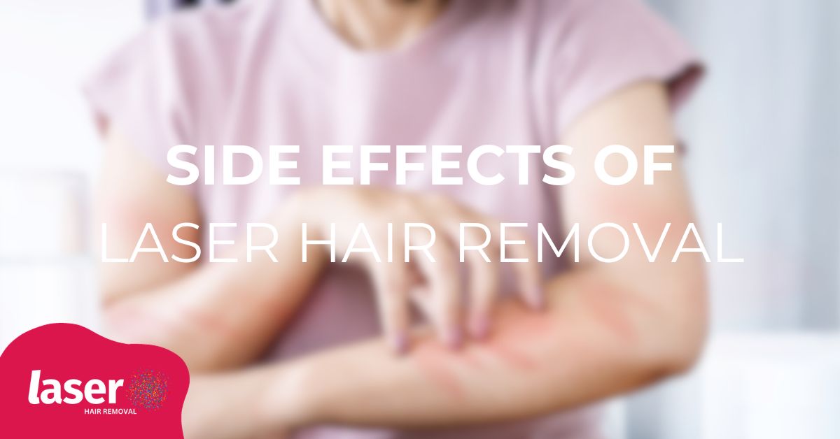 Side effect of laser hair removal