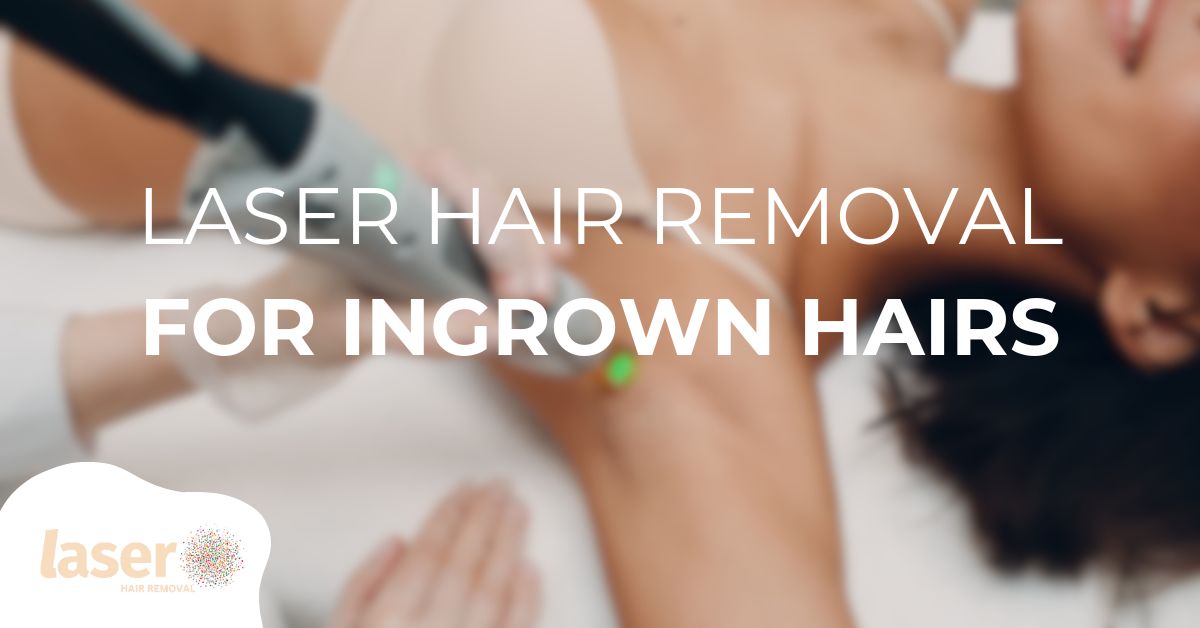 laser hair removal for ingrown hairs