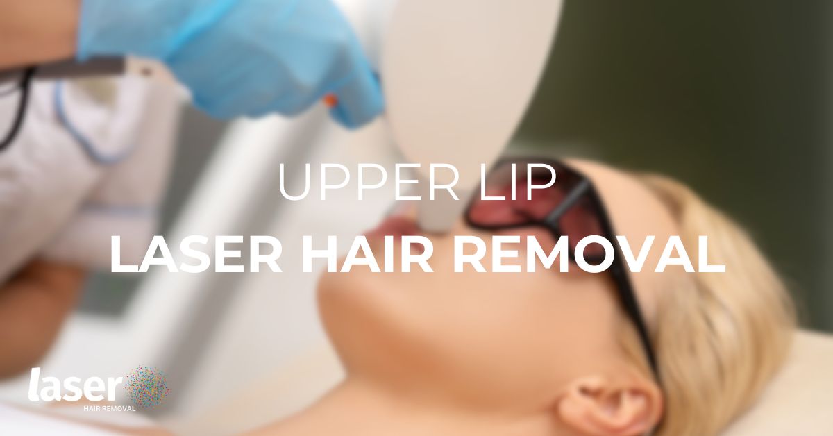 Upper lip laser hair removal