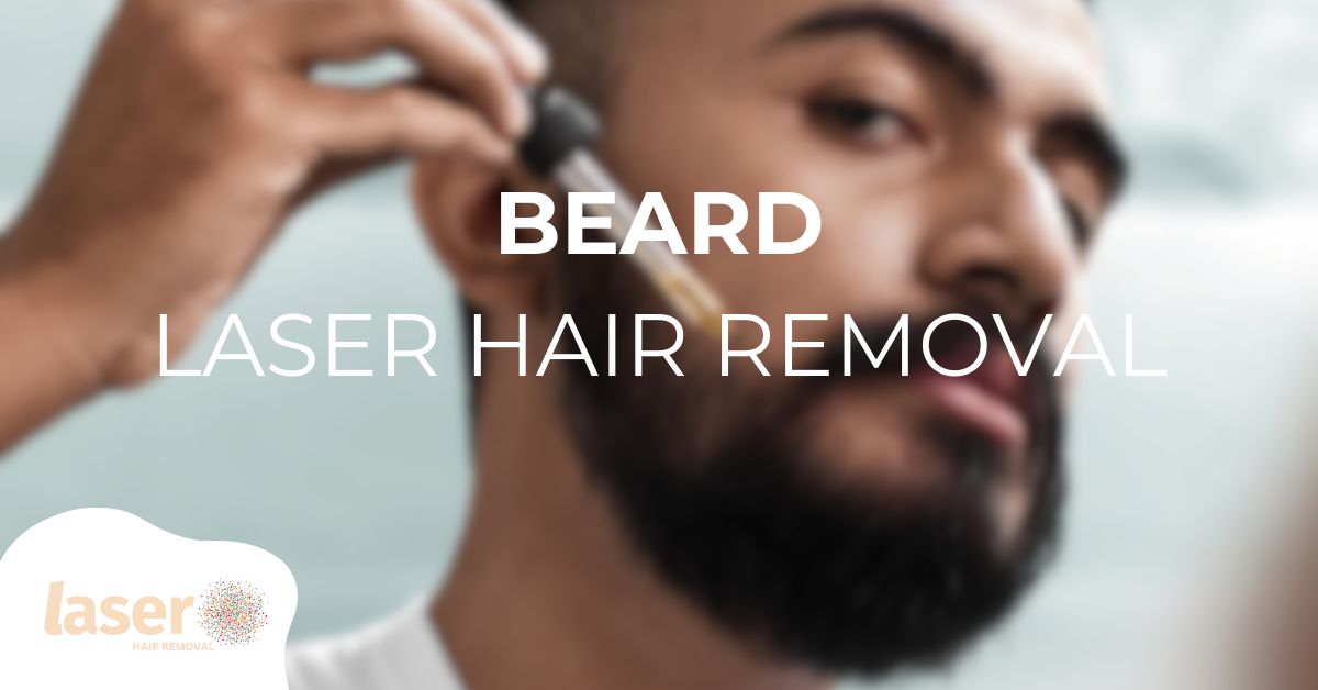 Beard laser hair removal