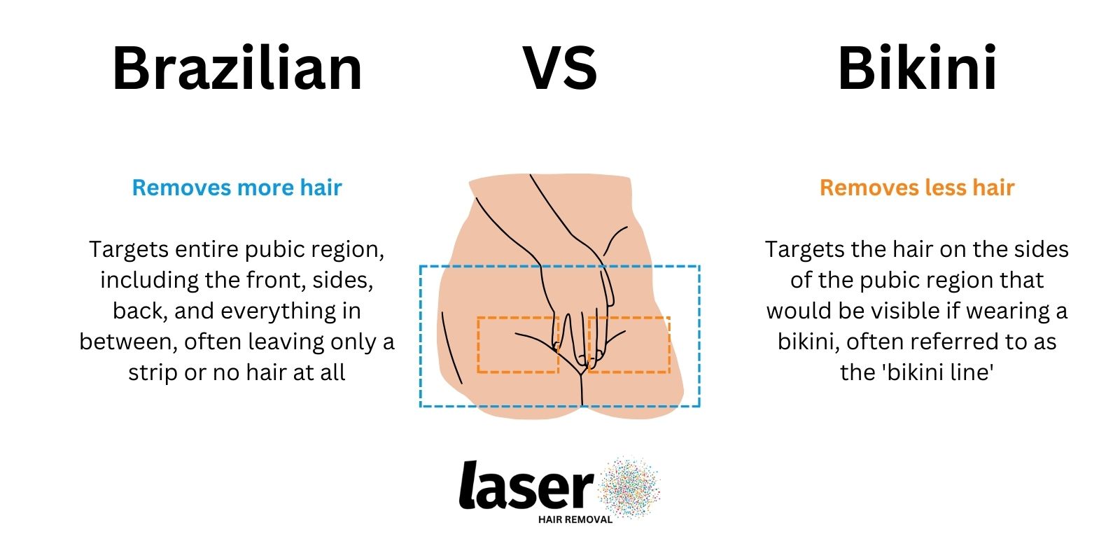 Brazilian laser hair removal vs Bikini laser hair removal