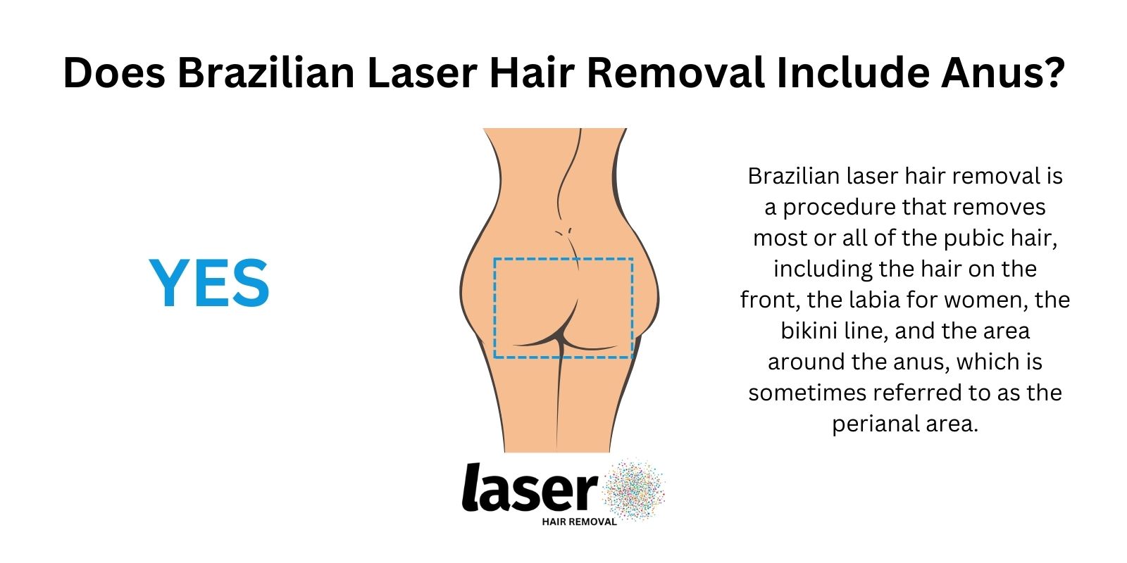 Does Brazilian Laser Hair Removal Include Anus?