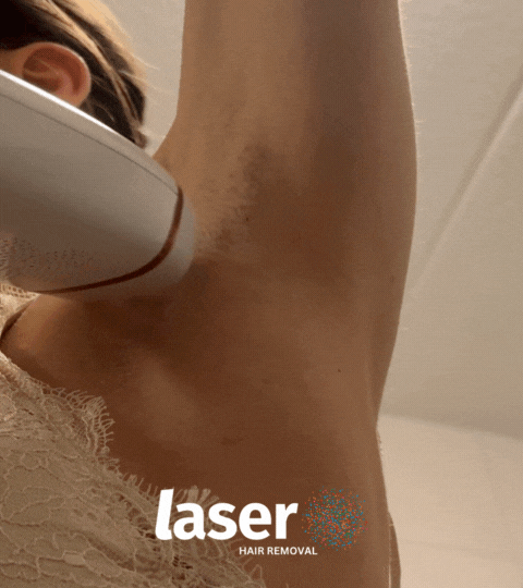 Timca using the Nood falsher 2.0 hair removal device